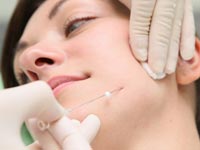 Биоармирование мезонитями Биоармирование мезонитями